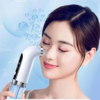 Electric Blackhead Vacuum Remover